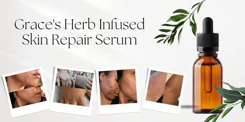 Skin Repair Serum 4oz.