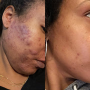 Skin Repair Serum 2oz.