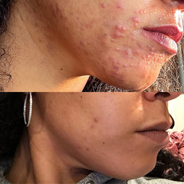 Skin Repair Serum 2oz.